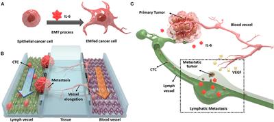 Microfluidic System to Analyze the Effects of Interleukin 6 on Lymphatic Breast Cancer Metastasis